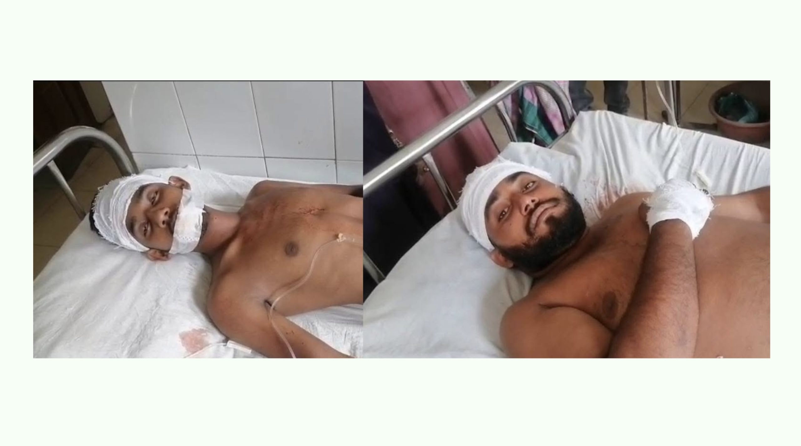 শ্রীনগরের জমি সংক্রান্ত বিরোধের জেরে চারজনকে কুপিয়ে আহত